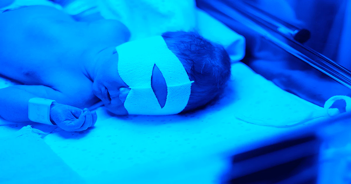6 weetjes over geelzucht (icterus) bij de baby